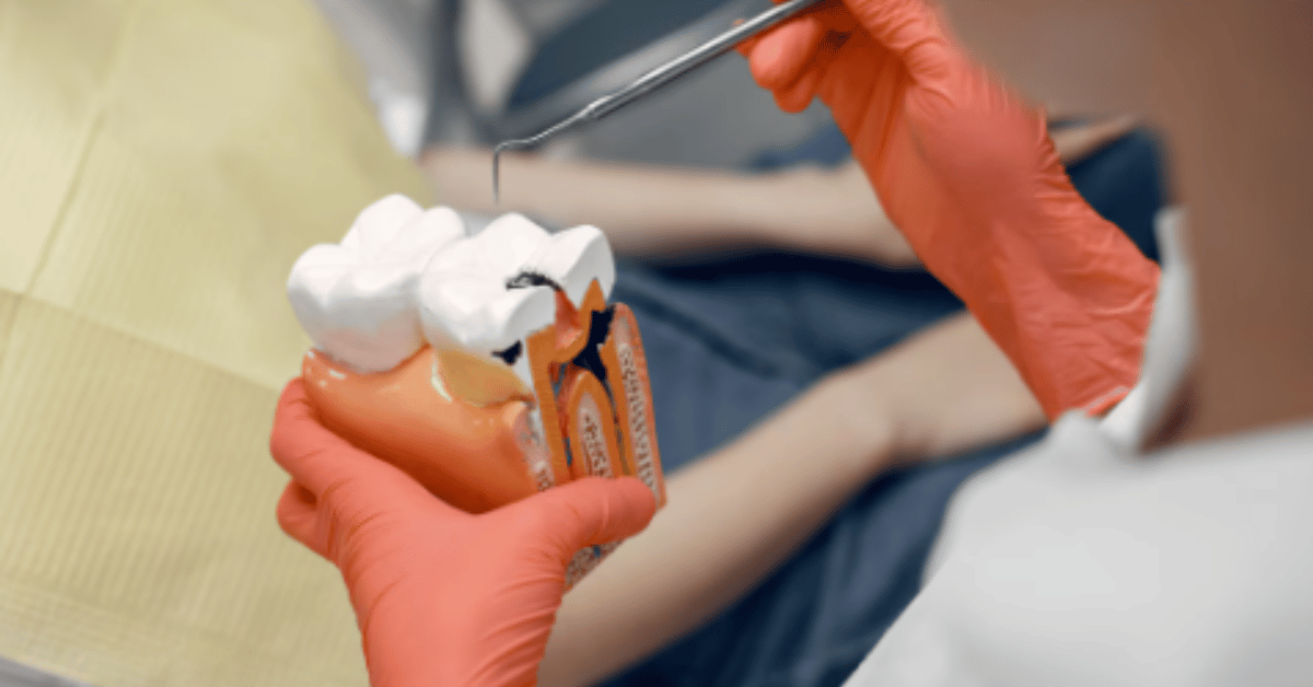 dental bone graft